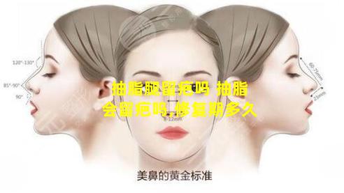 抽脂腿留疤吗 抽脂会留疤吗,修复期多久